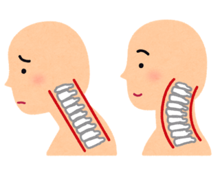 sick_straight_neck.png